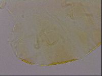 Echiniscus quadrispinosus image