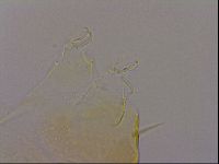 Echiniscus quadrispinosus image