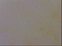 Echiniscus quadrispinosus image