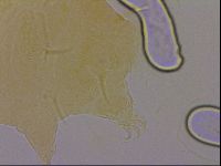 Echiniscus quadrispinosus image