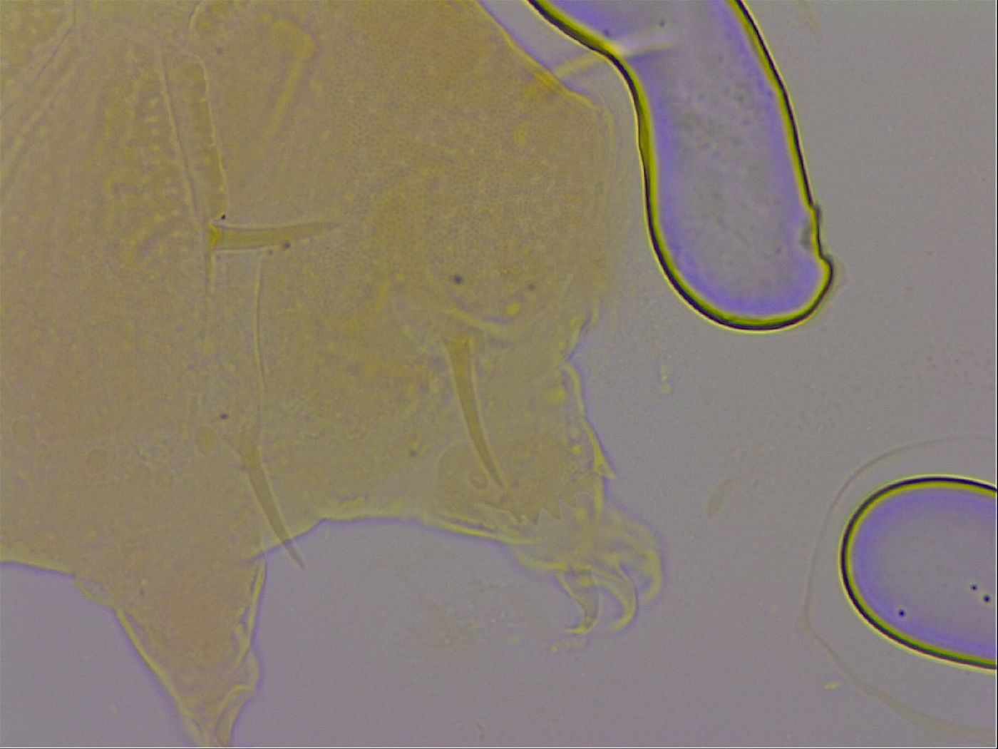 Echiniscus quadrispinosus image