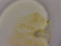 Echiniscus quadrispinosus image
