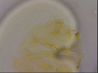 Echiniscus quadrispinosus image
