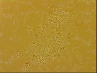 Echiniscus quadrispinosus image