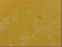 Echiniscus quadrispinosus image