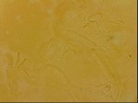 Echiniscus quadrispinosus image