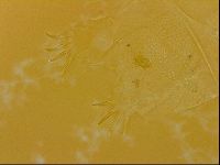Echiniscus quadrispinosus image