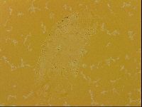 Echiniscus quadrispinosus image