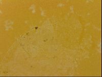 Echiniscus quadrispinosus image