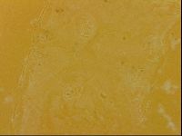Echiniscus quadrispinosus image