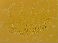 Echiniscus quadrispinosus image