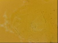 Echiniscus quadrispinosus image