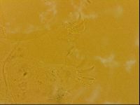Echiniscus quadrispinosus image