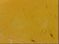 Echiniscus quadrispinosus image