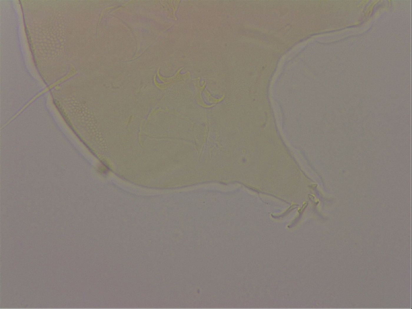 Echiniscus robertsi image