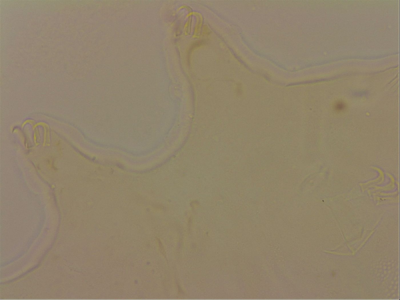 Echiniscus robertsi image