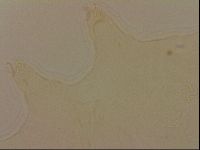 Media resource of Echiniscus robertsi
