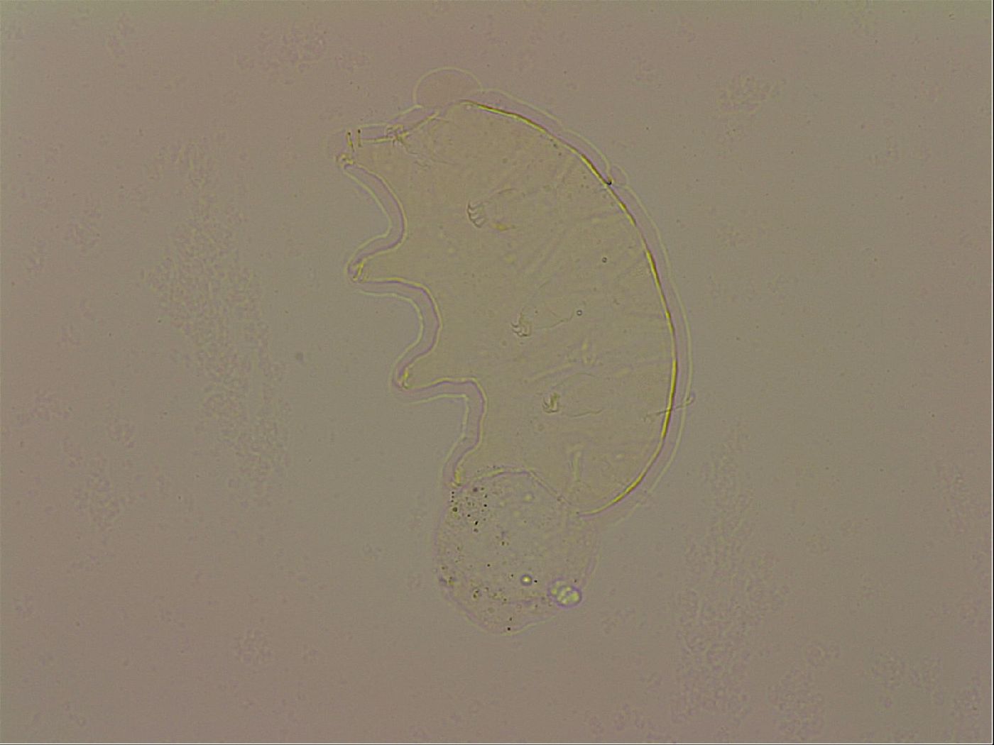 Echiniscus robertsi image