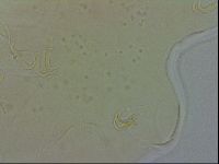 Echiniscus spiniger image