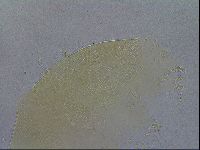 Echiniscus spiniger image