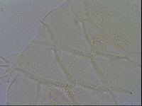 Echiniscus spiniger image