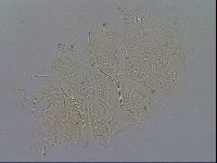 Echiniscus spiniger image