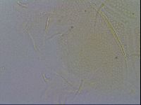 Echiniscus spiniger image