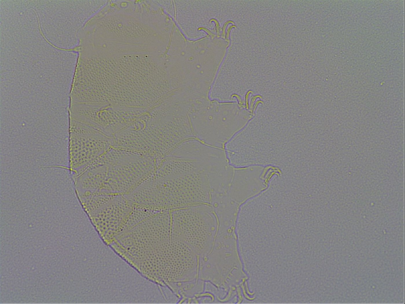Echiniscus spiniger image