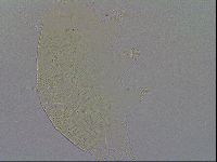 Echiniscus spiniger image
