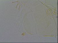 Echiniscus spiniger image