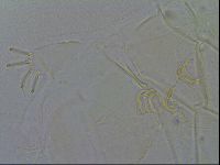 Echiniscus spiniger image