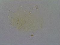 Echiniscus spiniger image