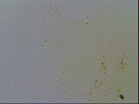 Echiniscus spiniger image