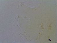Echiniscus spiniger image