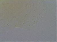 Echiniscus spiniger image