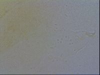 Echiniscus spiniger image