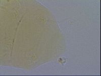 Echiniscus spiniger image