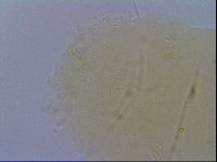 Echiniscus spiniger image