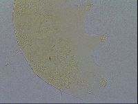 Echiniscus spiniger image