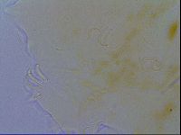 Echiniscus spiniger image