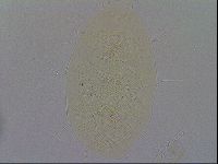 Echiniscus spiniger image