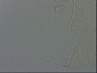 Echiniscus spiniger image