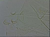 Echiniscus spiniger image