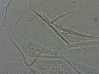 Echiniscus spiniger image