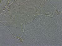 Echiniscus spiniger image