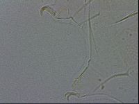 Echiniscus spiniger image