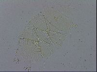 Echiniscus spiniger image