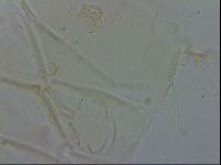 Echiniscus spiniger image