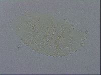 Echiniscus spiniger image