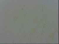 Echiniscus spiniger image